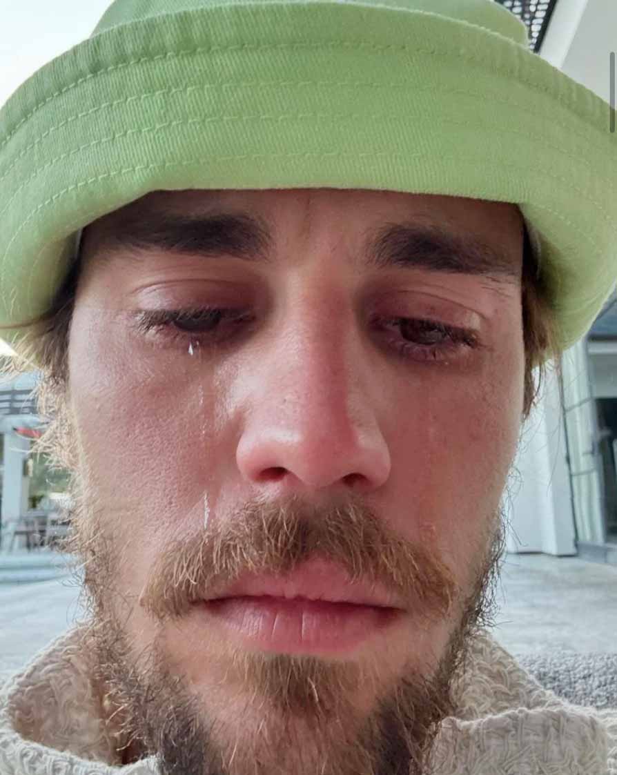 Fans concerned after Justin Bieber posts crying selfies