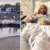 Aspiring doctor recovering after woman pushed him into lake