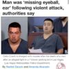 Man Eats Other Man’s Face, Eyeball, and Ear In Las Vegas