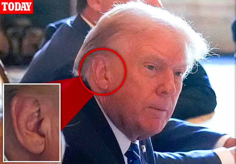 Photo of Trump’s intact ear sparks wild conspiracy theories