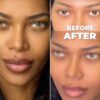 Jessica White undergoes permanent eye color surgery