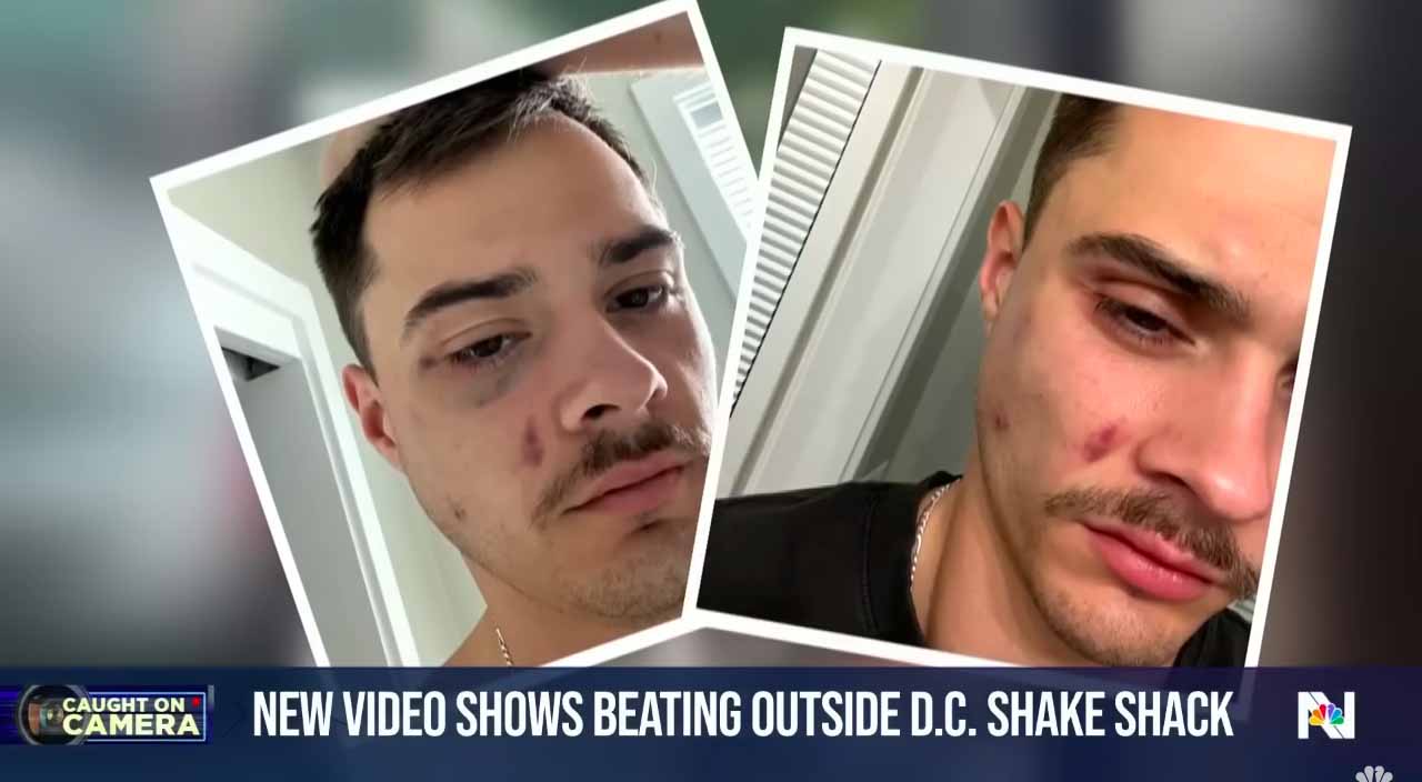 Shake Shack suspends workers who attacked 2 gay men for kissing