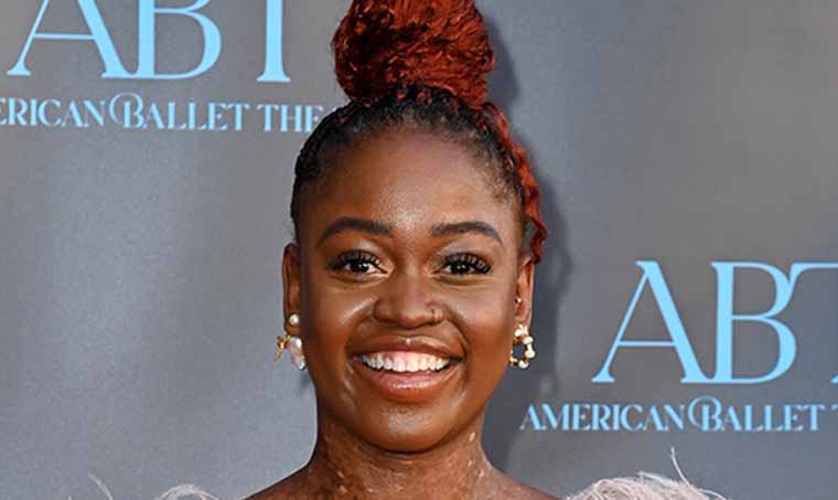 RIP: Ballerina Michaela DePrince, Who Danced for Beyonce, Dies Suddenly At 29